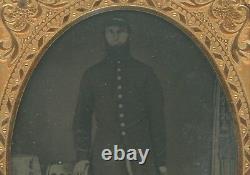 1/4 Plate Civil War Ambrotype of Union Soldier in Frock Coat Missing Fingers