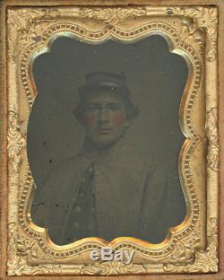 1/9 Plate Civil War Ambrotype Handsome Union Soldier Large Brass Buttons