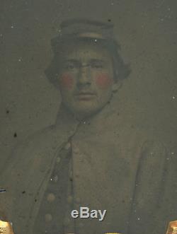 1/9 Plate Civil War Ambrotype Handsome Union Soldier Large Brass Buttons