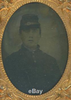 1/9 Plate Civil War Ambrotype of Young Union Soldier Wearing Frock Coat