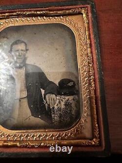 Civil War 1/6th Plate Ambrotype Image Of Soldier Missing Part Of His Finger