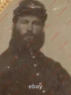 Civil War Soldier Huge Beard Union 1/9 Plate Tintype Half-Case PHOTO Army Unif
